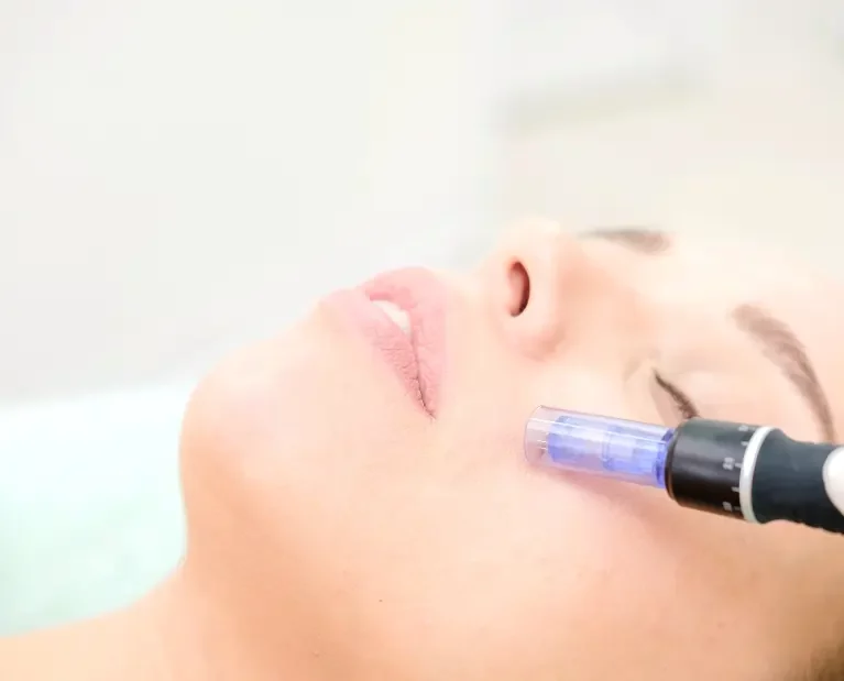 microneedling-micro-needling-facial-kosmetik-kosmetikstudio-weil-am-rhein-bb-beauty-schonheitssalon